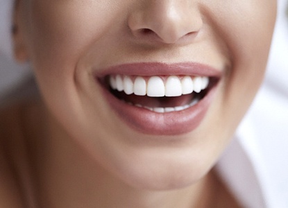 An up-close view of a person’s smile, complete with multiple dental implants and a custom-made bridge