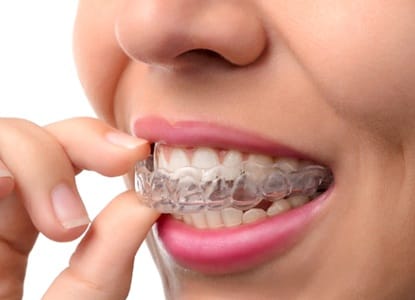 A woman removing her clear aligner.