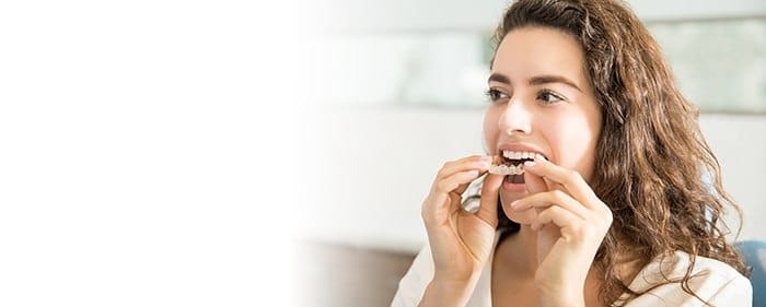 Invisalign special coupon