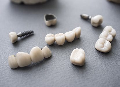 Implant supported restorations prior to placement