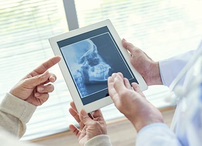 Dentist looking at jaw and skull x-rays