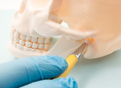 Model of jaw and skull bone