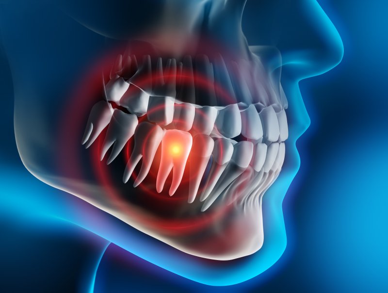 a digital image of tooth pain occurring within a person’s mouth 